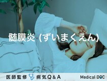 「髄膜炎」とは？症状・原因・検査についても解説！【医師監修】