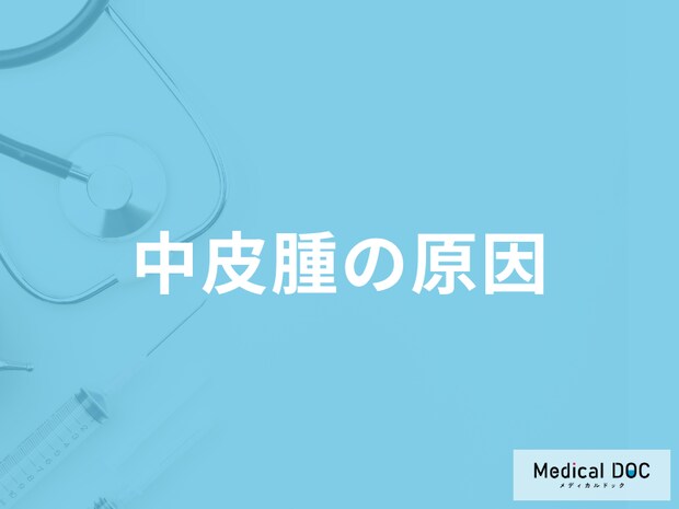 「中皮腫の原因」はご存じですか?アスベスト以外の可能性も医師が解説!