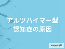 「アルツハイマー型認知症の原因」はご存知ですか？医師が解説！