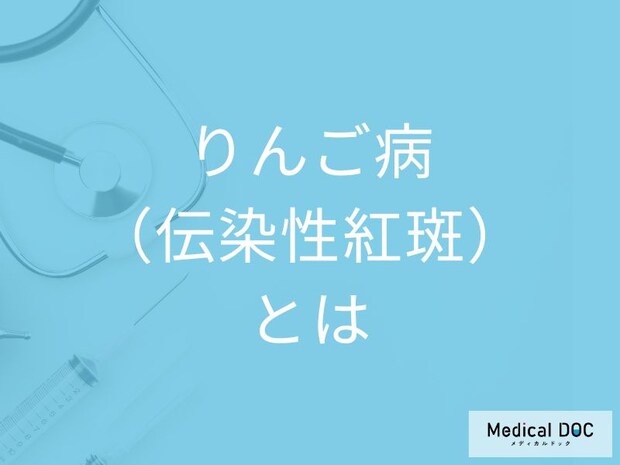 「りんご病(伝染性紅斑)」は発疹以外に何の症状が現れる?症状を医師が解説!