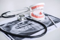 インプラントができない人の特徴を歯科医が解説 奥歯･前歯で違う? 治療できない場合の理由とは