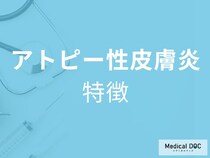 「アトピー性皮膚炎の具体的な症状」はご存じですか？医師が徹底解説！