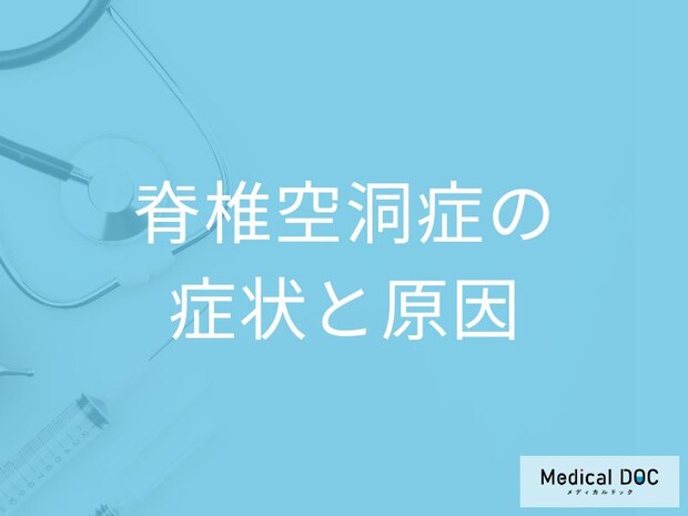 「脊椎空洞症」の症状や原因はご存知ですか？【医師監修】