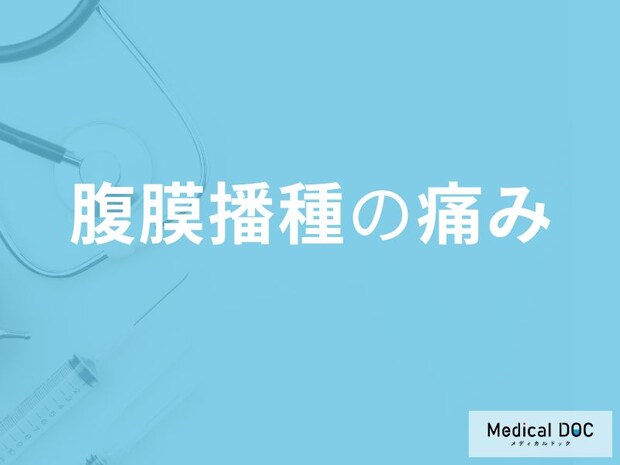 「腹膜播種」になると腹部に「どんな痛み」が現れるかご存じですか？医師が解説！