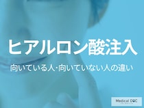 「ヒアルロン酸注入」が向いている人･向いていない人の違いとは? 施術を受ける前の注意点も皮膚科医が解説!