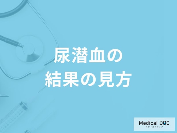 「尿潜血」の結果の見方はご存知ですか？再検査が必要な数値も医師が解説！