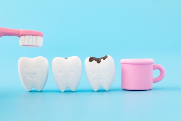 むし歯の段階とは？進行度合い別の特徴や症状、治療法を解説します