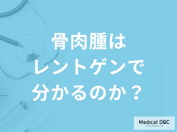 「骨肉腫を疑った場合レントゲン」でわかるのか?症状と検査法について医師が解説!