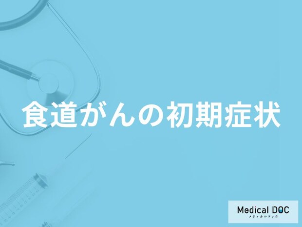 「食道がんの前兆となる2つの初期症状」はご存知ですか?末期症状も医師が解説!