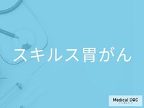 「スキルス胃がん」の初期症状をご存じですか？ 早期発見のポイントを併せて医師が解説
