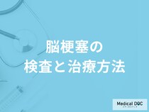 「脳梗塞」を起こした時「顔」にどんな症状が現れる？検査法も医師が解説！