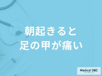 「朝起きると足の甲が痛い」のは扁平足が原因？対処法についても医師が解説！
