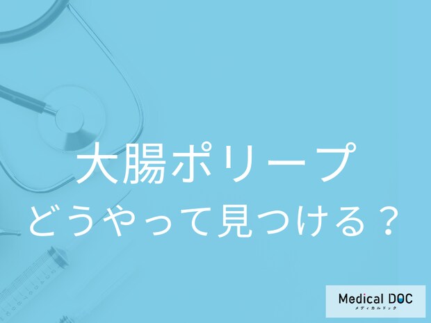 「大腸ポリープ」を放置してもがんにはならない? どうしたら発見できる?【医師監修】