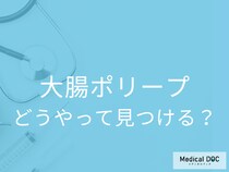 「大腸ポリープ」を放置してもがんにはならない? どうしたら発見できる?【医師監修】