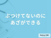 「ぶつけてないのにあざができる」原因はご存知ですか？医師が徹底解説！