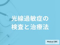 「光線過敏症の治療法」はご存じですか？外出する際の注意点も医師が解説！
