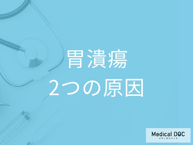 “ストレスで胃に穴が開く”は少数派 「胃潰瘍」の2大原因はご存じですか? 医師が解説!
