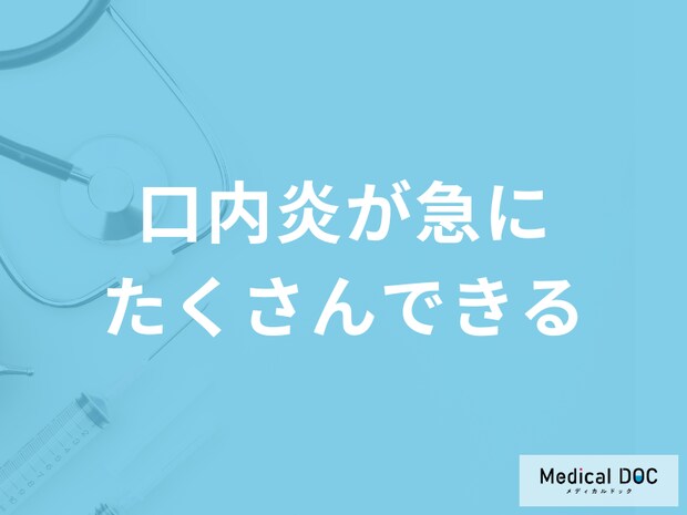 「口内炎が急にたくさんできる」のはがんの可能性がある?考えられる病気を医師が解説!