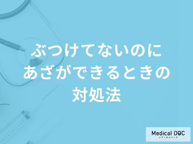 「ぶつけてないのにあざができる」の対処法はご存知ですか？医師が徹底解説！