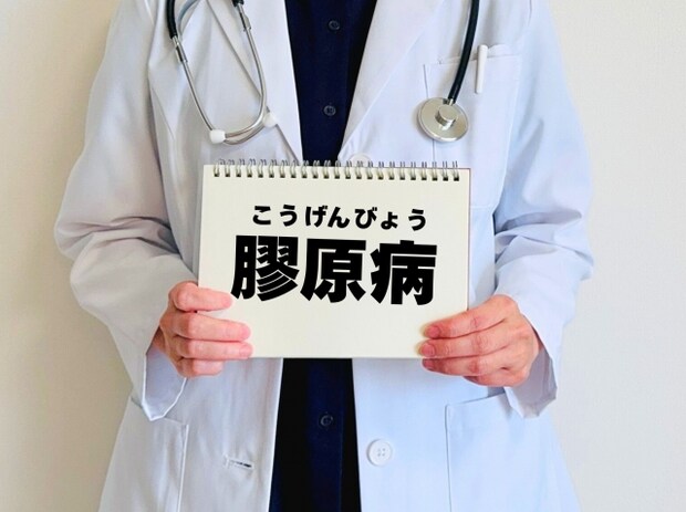 シェーグレン症候群|治療の基礎知識