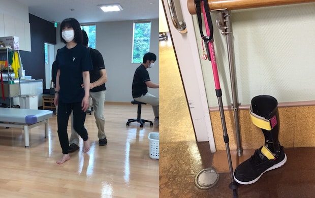 半年間のリハビリ生活を経て復職へ