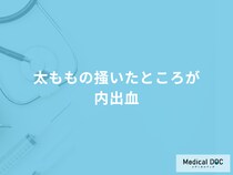 「太ももの掻いたところが内出血」する原因とは？考えられる病気も医師が解説！