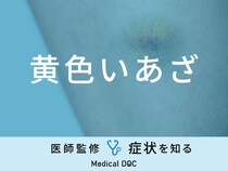 「黄色いあざ」ができる原因はご存知ですか？医師が考えられる病気も解説！