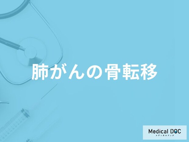 「肺がんの骨転移の好発部位」はご存知ですか?【医師監修】