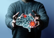 睡眠薬にアルツハイマー病予防効果がある可能性を発表【医師による海外医学論文解説】