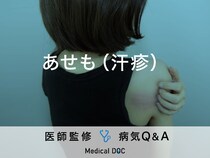 「あせも（汗疹）」の症状・原因・対処法はご存知ですか？医師が監修！