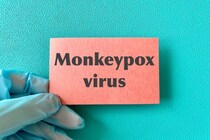 日本でも「サル痘」感染者確認、WHOは緊急事態宣言。感染を防ぐにはどうすればいい？