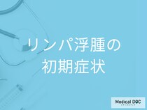 「リンパ浮腫」の初期症状はご存知ですか？ 特徴的な症状を医師が解説!