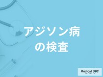難病「アジソン病」を疑ったらは何科に受診すれば良いかご存じですか？医師が解説！