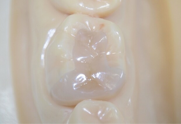 セレックの仕組みとは？メリット・デメリット、費用の目安を解説します