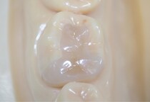 セレックの仕組みとは？メリット・デメリット、費用の目安を解説します