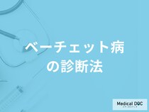 難病「ベーチェット病」はどのようにして診断されるかご存じですか？医師が解説！