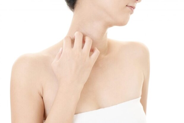 発疹に悩む女性