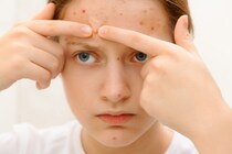 「毛嚢炎(もうのうえん)」とは？治療法・症状・原因についても解説！