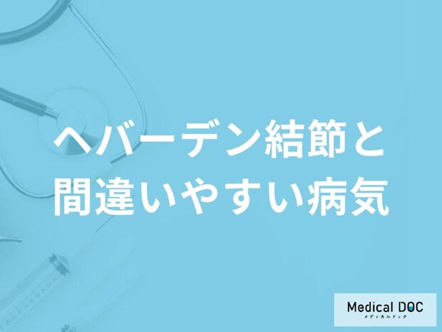 手指が曲がってしまう「へバーデン結節」の検査方法について解説!