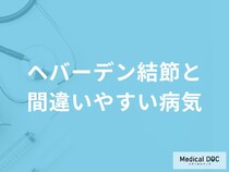 手指が曲がってしまう「へバーデン結節」の検査方法について解説！