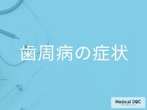 「歯周病の初期症状」はご存知ですか？進行すると現れる症状も解説！【医師監修】
