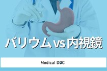 【医師解説】胃がん･食道がん検査 バリウムと内視鏡どちらがいい? 違いや何歳から受けるべきかも説明