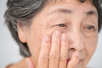 「白内障」で気になる眼内レンズの寿命を眼科医が解説 人生100年時代に向けて上手なレンズ選びを