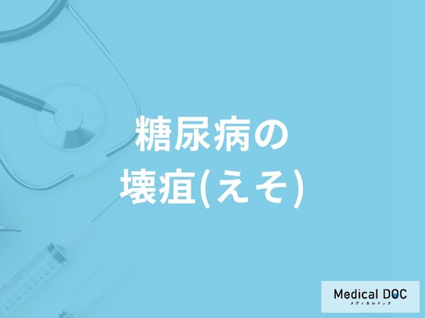 「糖尿病の壊疽（皮膚障害）」になるとどんな症状が現れる？壊疽の初期症状も解説！