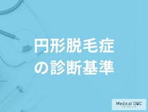 「円形脱毛症の診断基準」は何かご存じですか？医師が解説！