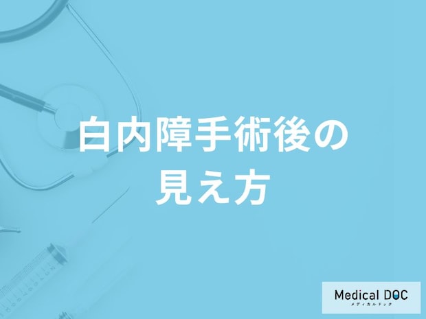 「白内障手術後の視界」はどのように変化するの？【医師監修】