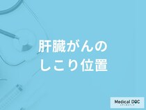 「肝臓がん」を発症すると「しこり」はどの位置にできるかご存知ですか？【医師監修】