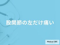 「股関節の左だけ痛い」原因をご存知ですか？医師が男女別の原因についても解説！