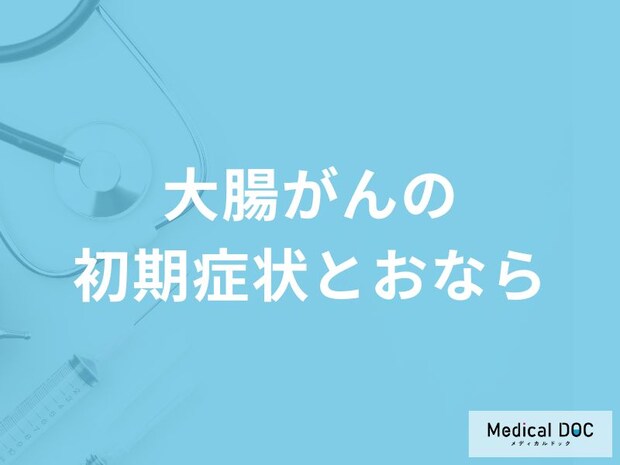 「大腸がんの初期症状」と「おなら」の関係性とは？医師が監修！