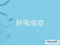 「肝吸虫症」を発症した人に起こる症状をご存じですか？【医師監修】